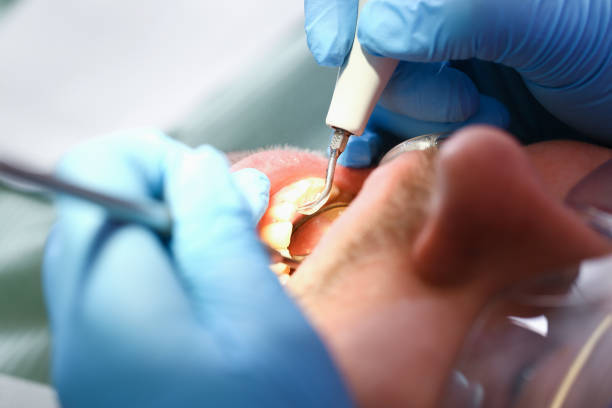 Best Emergency Dental Extractions in Los Fresnos, TX